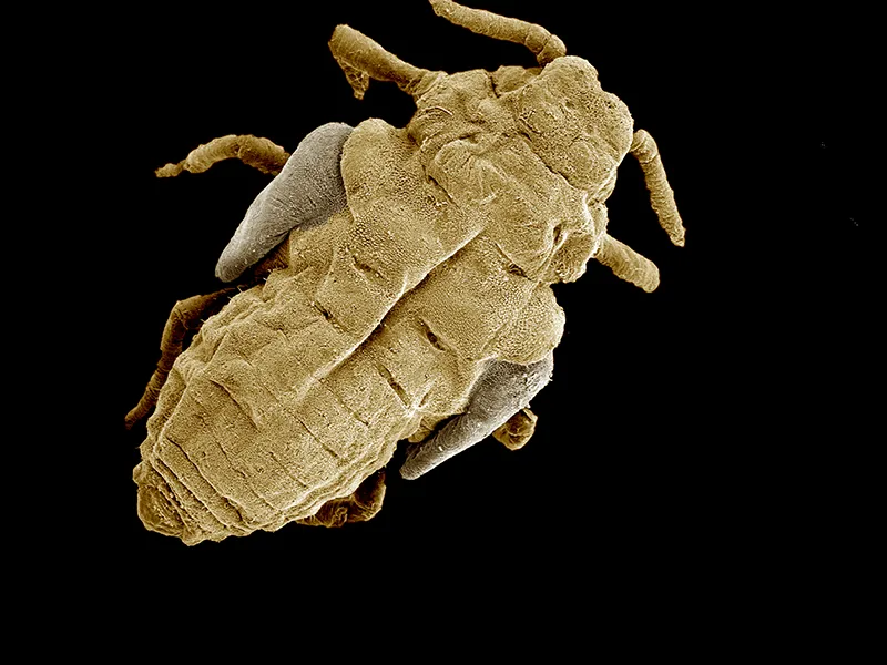 Head Lice Treatment: A Calm, Step-by-Step Guide for Parents