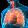 What is Respiratory Therapy?
